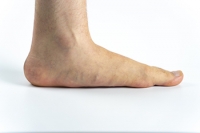 Causes and Effective Exercises for Flat Feet