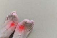 Understanding Different Types of Gout